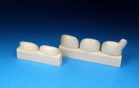Barracuda Studios BCR32154 Messerschmitt Bf-109G-10 (Bf-109G5 to Bf-109G-14) Cowl Gun Bulges (designed to be used with Revell kits) 1/32